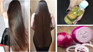 Onion Oil  - Hair treatment