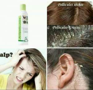 Anti-pelliculaire - Hair treatment on Aster Vender