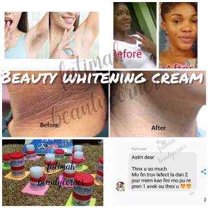Beauty whitening cream - Cream on Aster Vender
