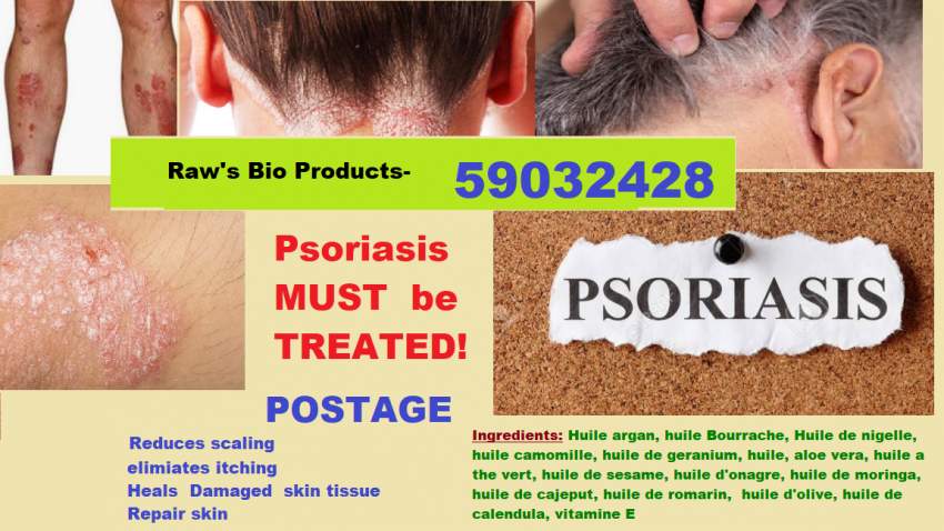 Your final resort and relief for PSORIASIS - 1 - Other face care products  on Aster Vender