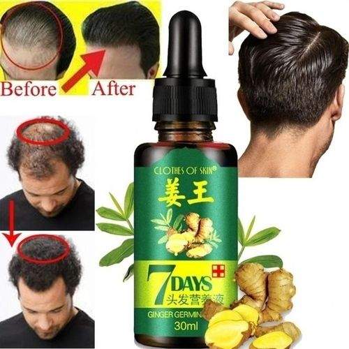 50% discount: FAST 100% natural anti HAIR LOSS SERUM. - 2 - Hair treatment  on Aster Vender
