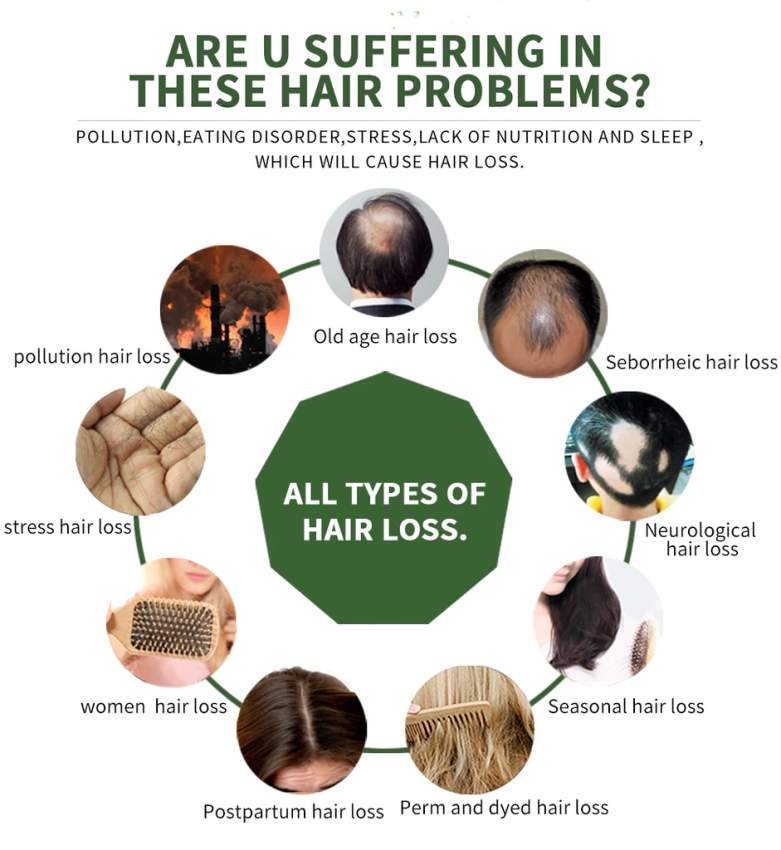 50% discount: FAST 100% natural anti HAIR LOSS SERUM. - 10 - Hair treatment  on Aster Vender