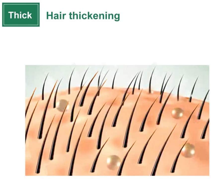 50% discount: FAST 100% natural anti HAIR LOSS SERUM. - 11 - Hair treatment  on Aster Vender