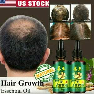 50% discount: FAST 100% natural anti HAIR LOSS SERUM. - 3 - Hair treatment  on Aster Vender