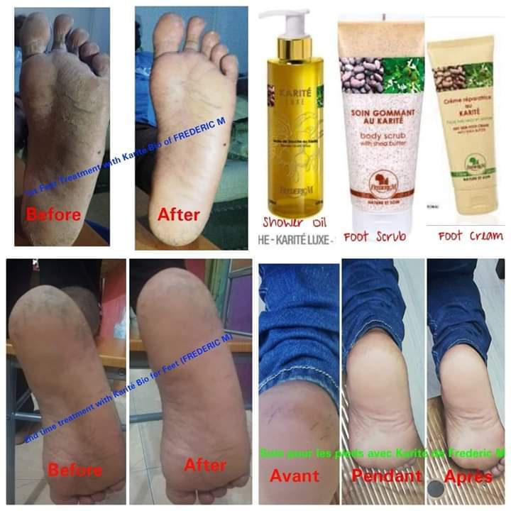 Produit kalité - 0 - Creams & Masks  on Aster Vender