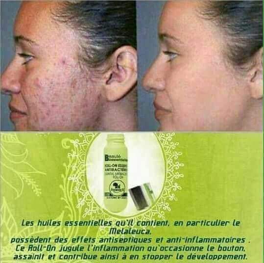 Roll on purifiant - 0 - Other face care products  on Aster Vender