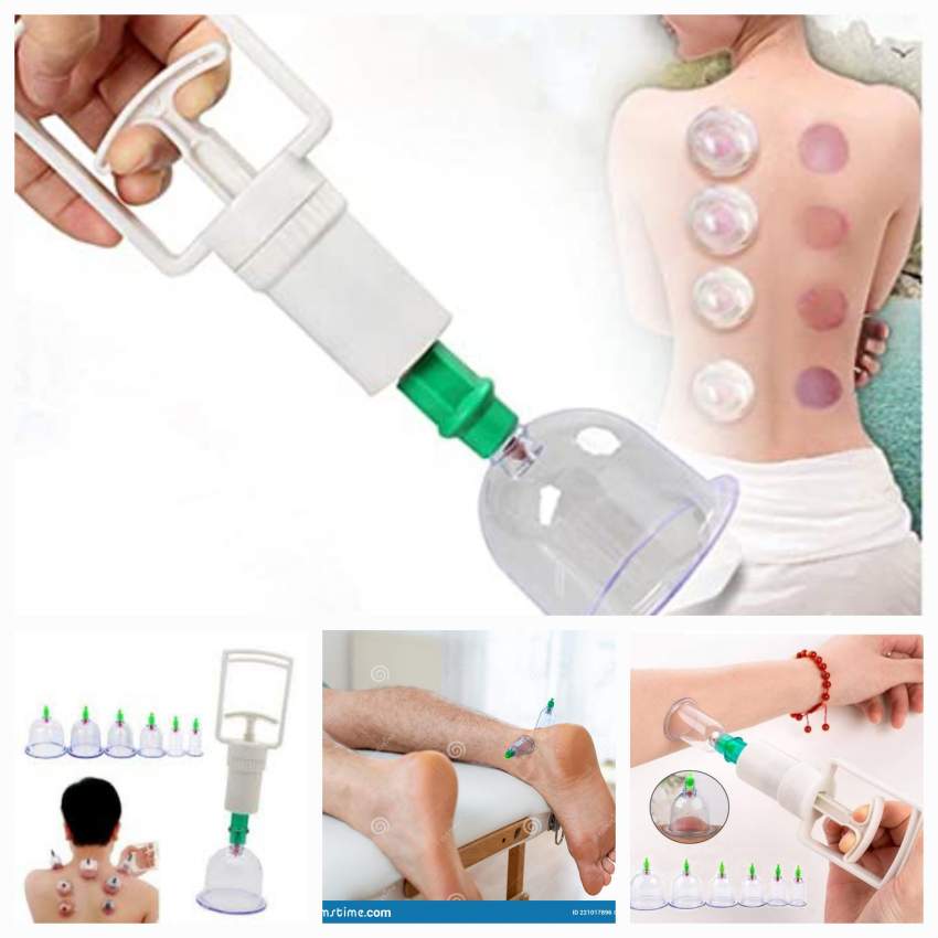 Cupping hijama tools 6pcs Rs 200 - 0 - Others  on Aster Vender