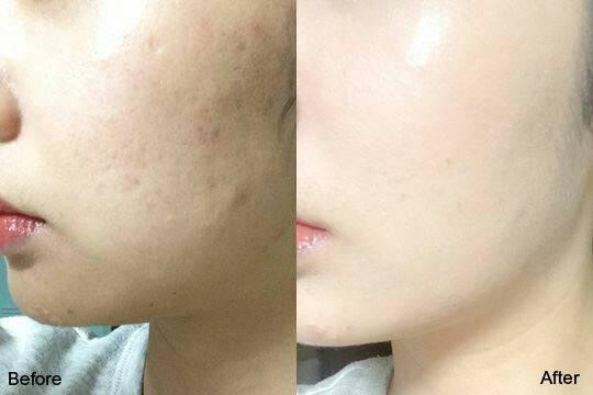 ORIGINAL WHITENING CREAM - 1 - Cream  on Aster Vender