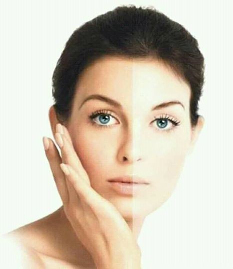 ORIGINAL WHITENING CREAM - 4 - Cream  on Aster Vender