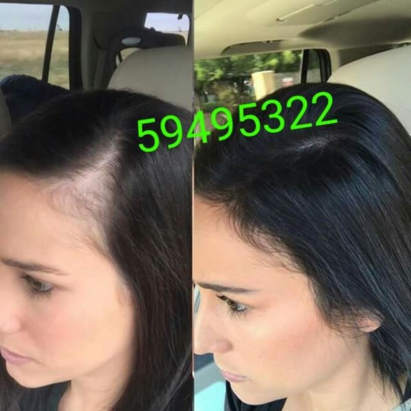 Antichute cheveux - 1 - Shampoo  on Aster Vender